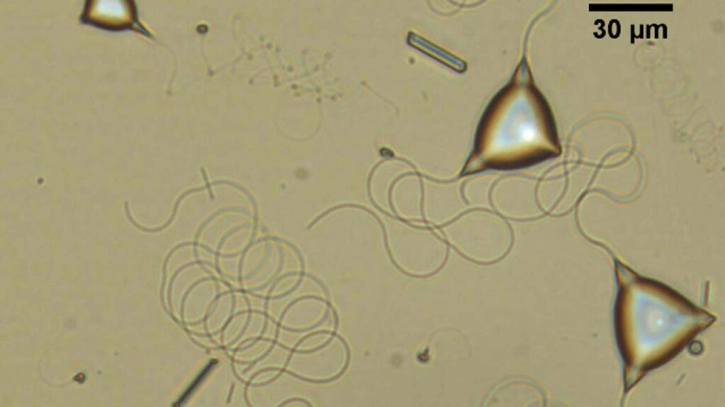robots microscópicos